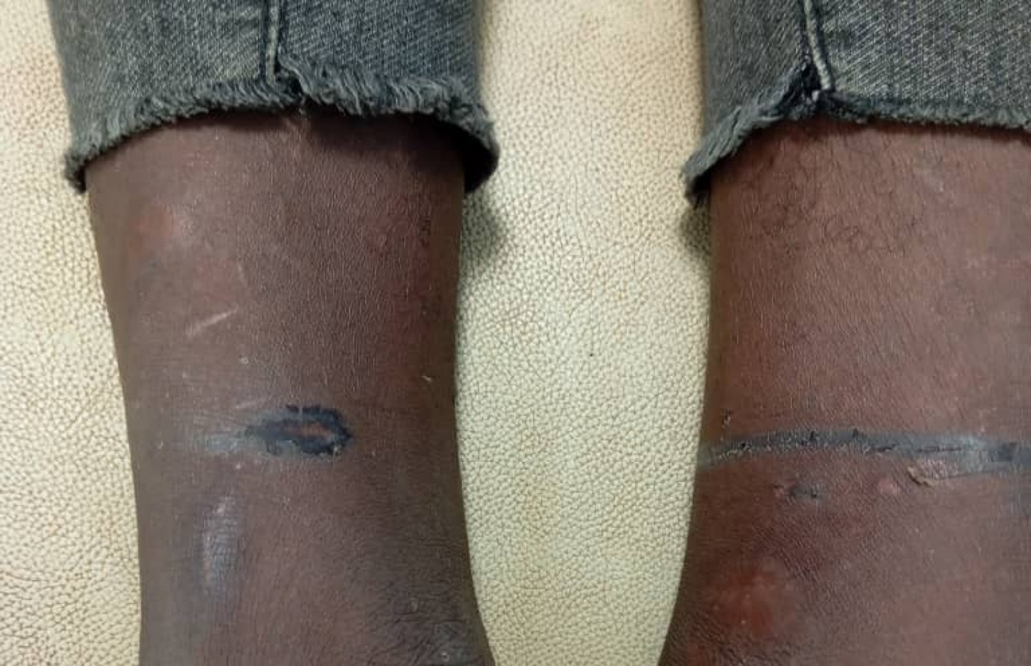 Côte d'Ivoire : Duekoué, un acte de torture révélé sur jeune vigile électrocuté, l'employeur interpellé, ses complices en fuite