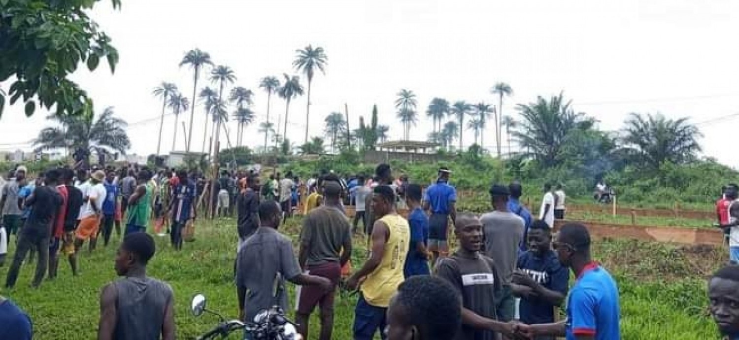 Côte d'Ivoire : Cruauté à Akoupé-Zeudji, un garçon de 10 ans brûlé par son père et sa marâtre pour un prétendu vol d'argent