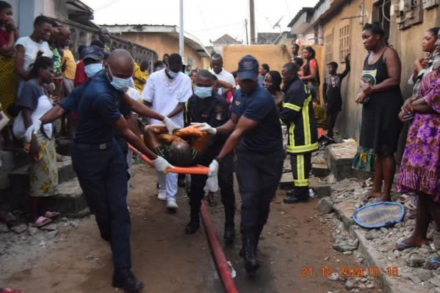 Côte d'Ivoire : Incendie à Yopougon, huit personnes gravement brûlées dans une chambre en feu