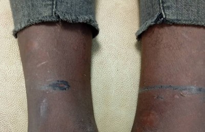 Côte d'Ivoire : Duekoué, un acte de torture révélé sur jeune vigile électrocuté, l'employeur interpellé, ses complices en fuite